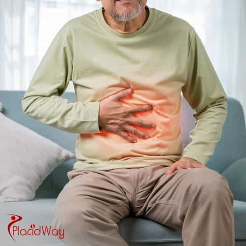 Gastric Sleeve Surgery in Turkey: The Affordable Weight Loss Solution for German Patients